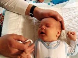 Непроходимость слезного канала у новорожденных